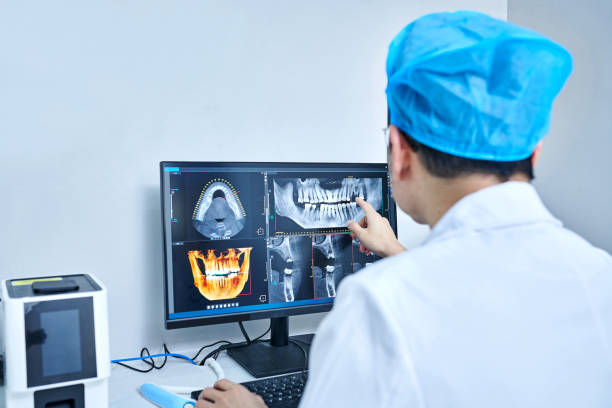 Best Chipped Tooth Repair Near Me  in Hood River, OR